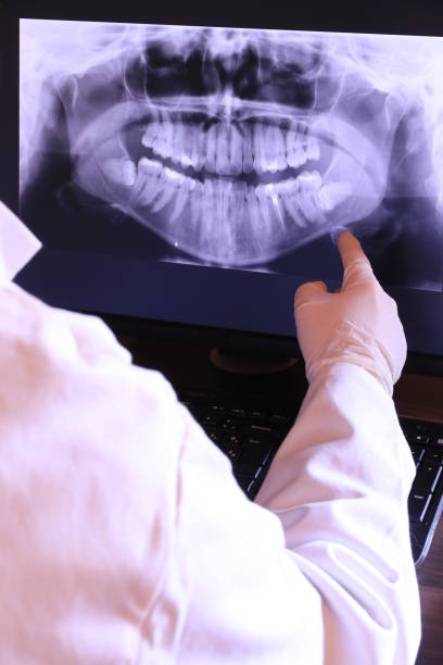 Best Emergency Dentist for Lost Fillings or Crowns in Country Club Hills, MO