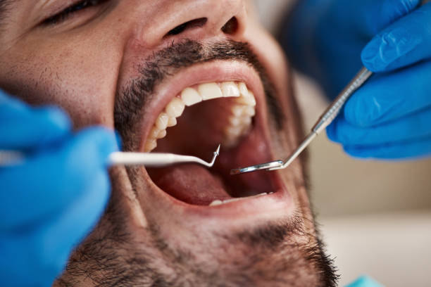 Best Emergency Dentist for Knocked-Out Tooth in Country Club Hills, MO